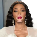 z czego znana jest Winnie Harlow