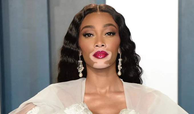 z czego znana jest Winnie Harlow